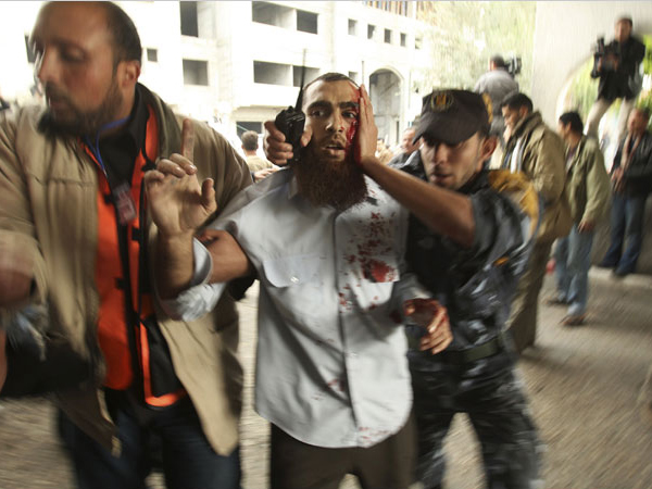 An injured man reaches out for help as hundreds of Palestinians are also killed and scores more wounded in the first hour of Israel’s massive attack on about 100 Hamas sites throughout Gaza in retaliation for the recent rocket fire from the area, Gaza, December 27, 2008.