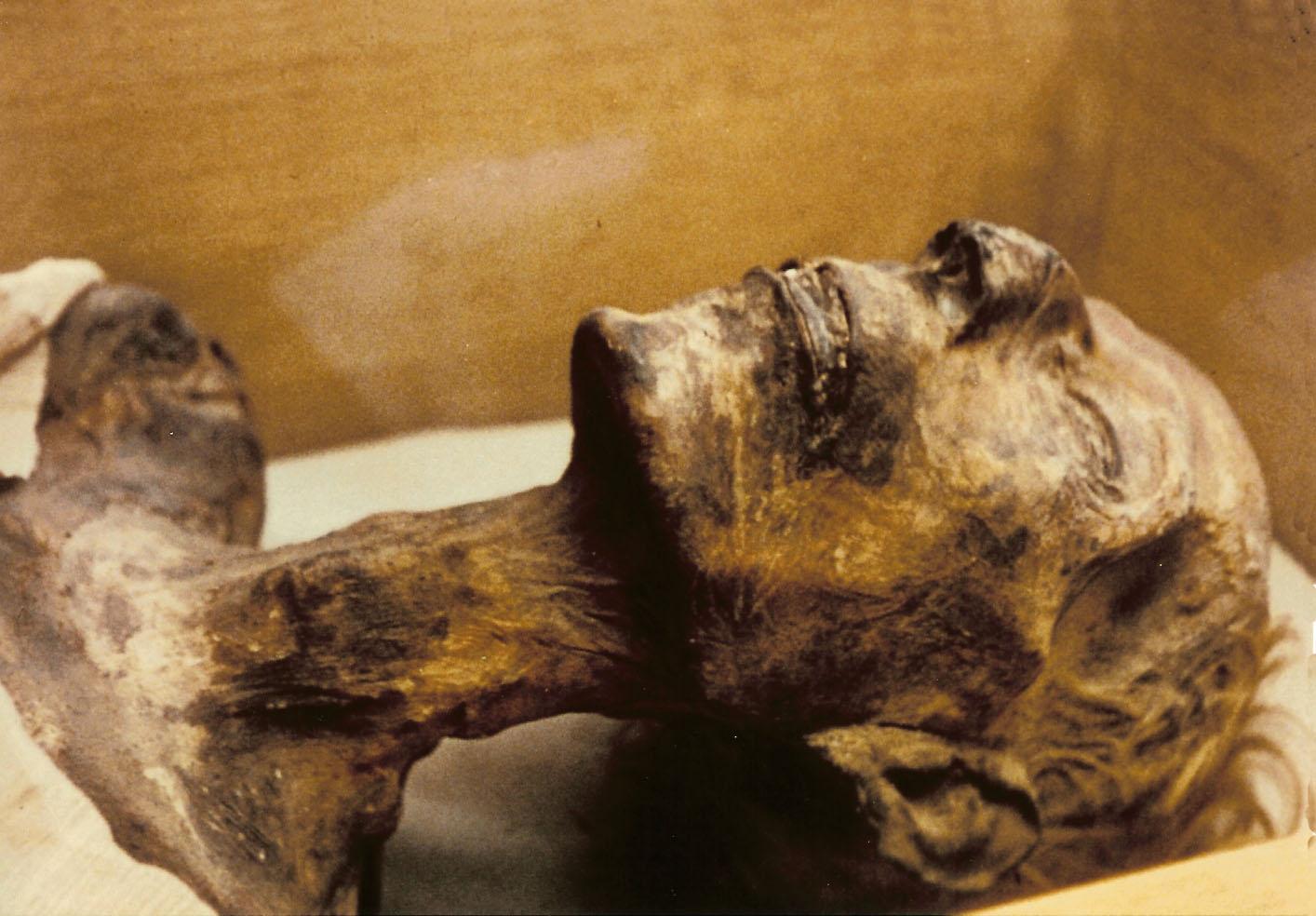 The mummy of Pharaoh Ramesses II, Egyptian Museum, Cairo.